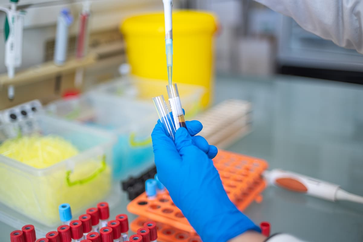 Prélèvement à domicile